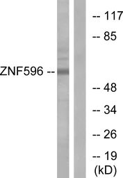 Anti-ZNF596 antibody used in Western Blot (WB). GTX87352