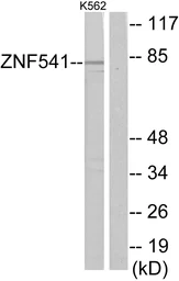 Anti-ZNF541 antibody used in Western Blot (WB). GTX87363