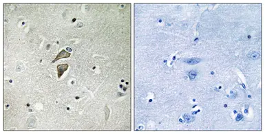 Anti-RNF149 antibody used in IHC (Paraffin sections) (IHC-P). GTX87367