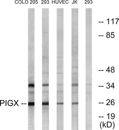 Anti-PIGX antibody used in Western Blot (WB). GTX87371