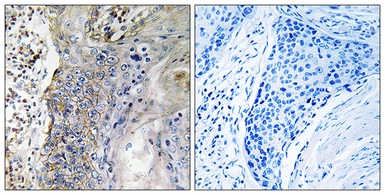 Anti-SLC28A2 antibody used in IHC (Paraffin sections) (IHC-P). GTX87380