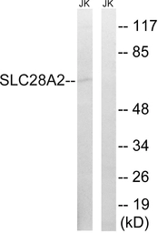Anti-SLC28A2 antibody used in Western Blot (WB). GTX87380