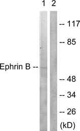 Anti-Ephrin B1/2 antibody used in Western Blot (WB). GTX87381