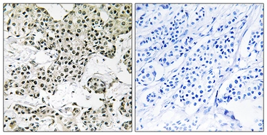 Anti-THOC5 antibody used in IHC (Paraffin sections) (IHC-P). GTX87386