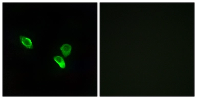 Anti-MRPS18C antibody used in Immunocytochemistry/ Immunofluorescence (ICC/IF). GTX87389