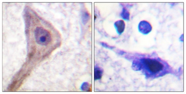 Anti-PRAS40 antibody used in IHC (Paraffin sections) (IHC-P). GTX87391