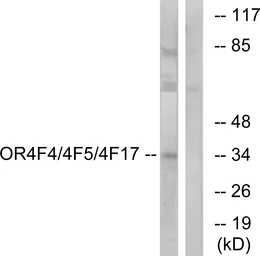 Anti-OR4F4 + OR4F5 + OR4F17 antibody used in Western Blot (WB). GTX87394
