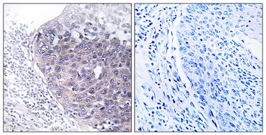 Anti-GTPBP5 antibody used in IHC (Paraffin sections) (IHC-P). GTX87399