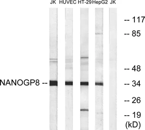 Anti-NANOGP8 antibody used in Western Blot (WB). GTX87402