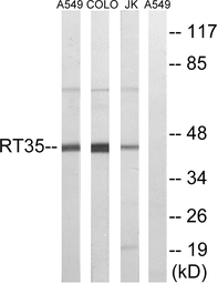 Anti-MRPS35 antibody used in Western Blot (WB). GTX87403