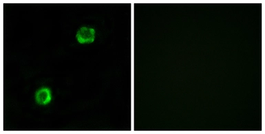 Anti-Apolipoprotein L2 antibody used in Immunocytochemistry/ Immunofluorescence (ICC/IF). GTX87407