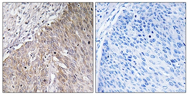 Anti-Apolipoprotein L2 antibody used in IHC (Paraffin sections) (IHC-P). GTX87407