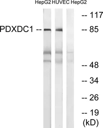 Anti-PDXDC1 antibody used in Western Blot (WB). GTX87408