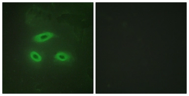 Anti-NKTR antibody used in Immunocytochemistry/ Immunofluorescence (ICC/IF). GTX87411