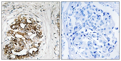 Anti-PKMYT1 antibody used in IHC (Paraffin sections) (IHC-P). GTX87414