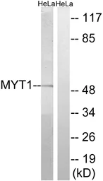 Anti-PKMYT1 antibody used in Western Blot (WB). GTX87414