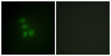 Anti-hnRNP G antibody used in Immunocytochemistry/ Immunofluorescence (ICC/IF). GTX87416
