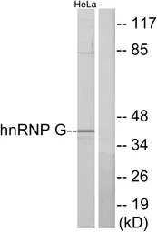 Anti-hnRNP G antibody used in Western Blot (WB). GTX87416