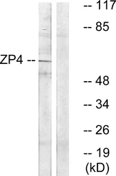 Anti-ZP4 antibody used in Western Blot (WB). GTX87417