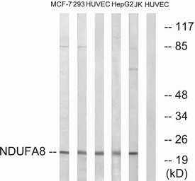 Anti-NDUFA8 antibody used in Western Blot (WB). GTX87418