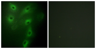 Anti-TRIM59 antibody used in Immunocytochemistry/ Immunofluorescence (ICC/IF). GTX87419