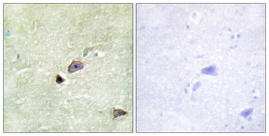 Anti-TRIM59 antibody used in IHC (Paraffin sections) (IHC-P). GTX87419