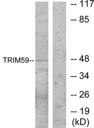 Anti-TRIM59 antibody used in Western Blot (WB). GTX87419