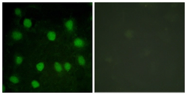 Anti-Dematin antibody used in Immunocytochemistry/ Immunofluorescence (ICC/IF). GTX87430