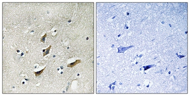 Anti-Dematin antibody used in IHC (Paraffin sections) (IHC-P). GTX87430