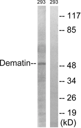 Anti-Dematin antibody used in Western Blot (WB). GTX87430