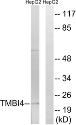 Anti-TMBIM4 antibody used in Western Blot (WB). GTX87431
