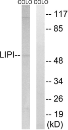 Anti-LIPI antibody used in Western Blot (WB). GTX87435