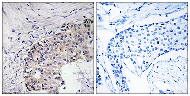 Anti-SCARF2 antibody used in IHC (Paraffin sections) (IHC-P). GTX87437