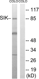 Anti-SIK antibody used in Western Blot (WB). GTX87439