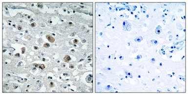 Anti-GASP1 antibody used in IHC (Paraffin sections) (IHC-P). GTX87441