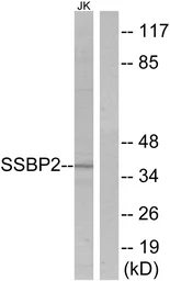 Anti-SSBP2 antibody used in Western Blot (WB). GTX87442