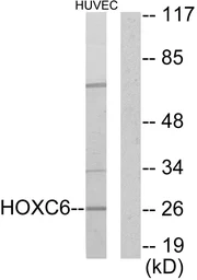 Anti-HOXC6 antibody used in Western Blot (WB). GTX87445