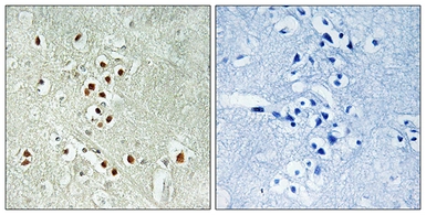 Anti-GADD45GIP1 antibody used in IHC (Paraffin sections) (IHC-P). GTX87447