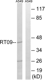 Anti-MRPS9 antibody used in Western Blot (WB). GTX87450