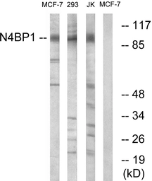 Anti-N4BP1 antibody used in Western Blot (WB). GTX87451