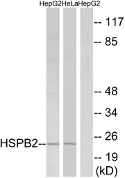 Anti-HSPB2 antibody used in Western Blot (WB). GTX87453