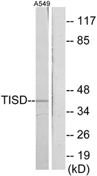 Anti-TIS11D antibody used in Western Blot (WB). GTX87458