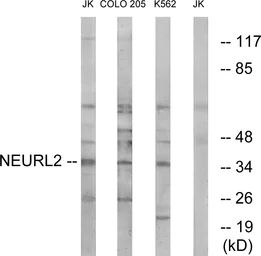 Anti-NEURL2 antibody used in Western Blot (WB). GTX87459