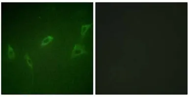 Anti-RyR2 antibody used in Immunocytochemistry/ Immunofluorescence (ICC/IF). GTX87462