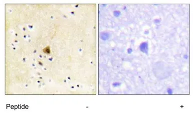 Anti-RyR2 antibody used in IHC (Paraffin sections) (IHC-P). GTX87462