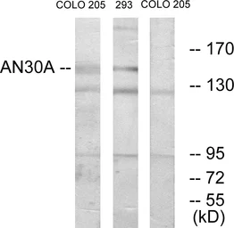 Anti-AN30A antibody used in Western Blot (WB). GTX87467