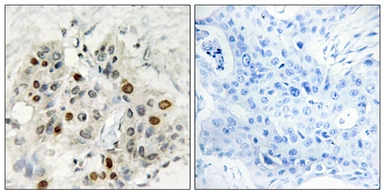 Anti-AF4 antibody used in IHC (Paraffin sections) (IHC-P). GTX87470