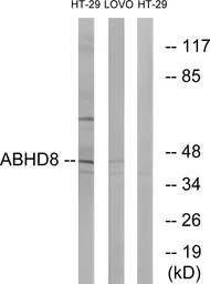 Anti-ABHD8 antibody used in Western Blot (WB). GTX87475