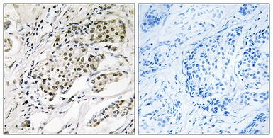 Anti-CDYL2 antibody used in IHC (Paraffin sections) (IHC-P). GTX87476