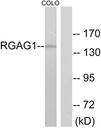 Anti-RGAG1 antibody used in Western Blot (WB). GTX87477